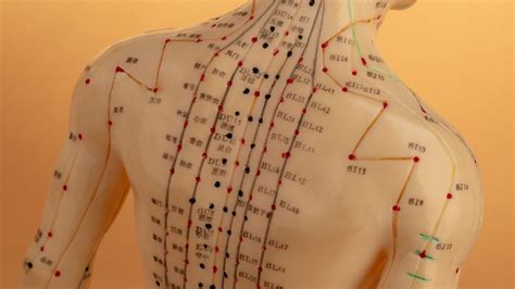Acupuncture 5