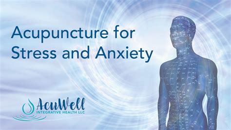 Acupuncture A Stress Based Model English Edition