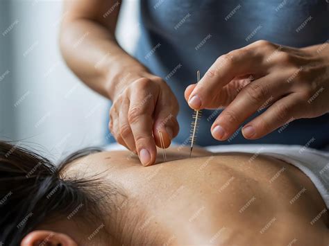 Acupuncture Therapy