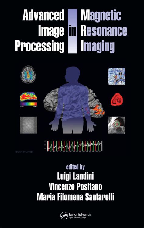 Advanced Image Processing In Magnetic Resonance Imaging Signal Processing And Communications