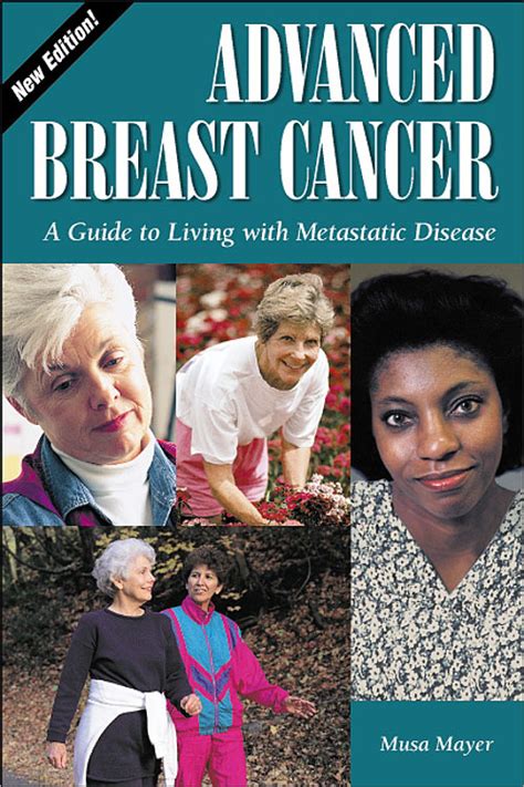 Full Download Advanced Breast Cancer A Guide To Living With Metastatic Disease 2Nd Edition Patient Centered Guides 