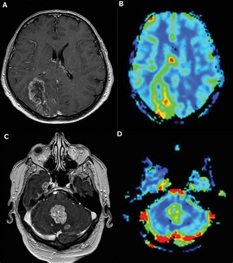 Read Online Advanced Mr Imaging Techniques In The Diagnosis Of 