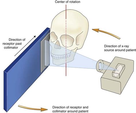 Advantages Of Panoramic Imaging When Contrasted With Intraoral Imaging Include