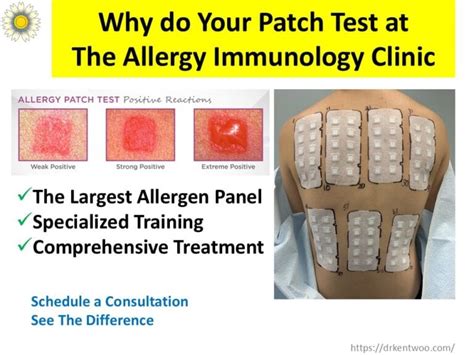 Aeros Patch Allergy