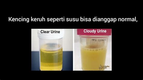 AIR KENCING KERUH - Jual Obat Sakit Kencing Keruh Terbaru - Oct 2024