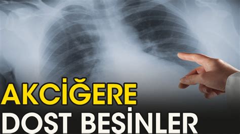 akciğer dostu besinler