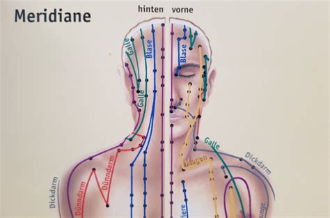 akupunktur schulter nacken