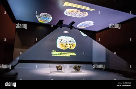 albert einstein brain in museum