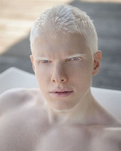 albino nude