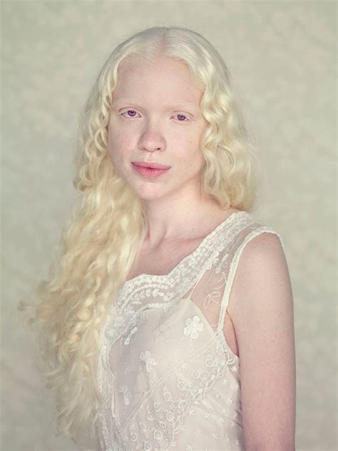 albino women nude