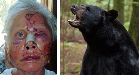 Allena Hansen Bear