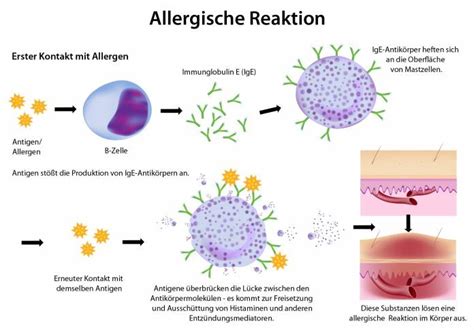allergie reactie