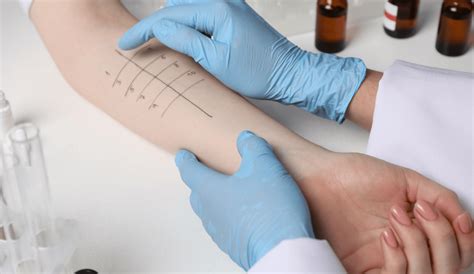 allergietest leipzig