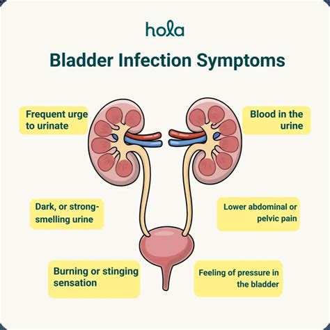 Alprim For Bladder Infection