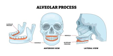 Alveolar Process Of Maxilla