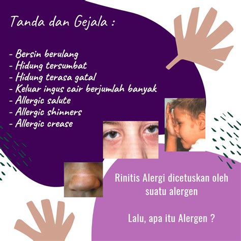alveolitis allergika adalah