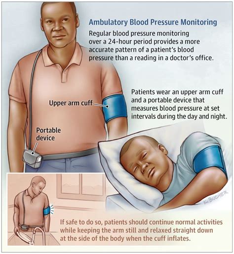 Read Ambulatory Blood Pressure Monitoring In Hypertensive 