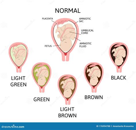 amniotic fluid color