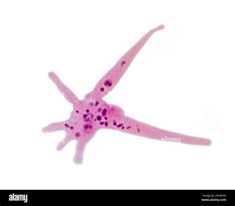 Amoeba Proteus Classification