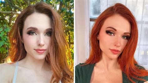 amouranth before surgery