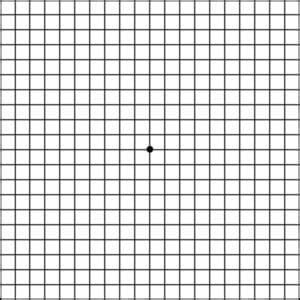amsler grid wills eye hospital amsler chart to test your sight american macular degeneration