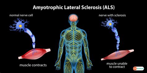 amyotrophic in English