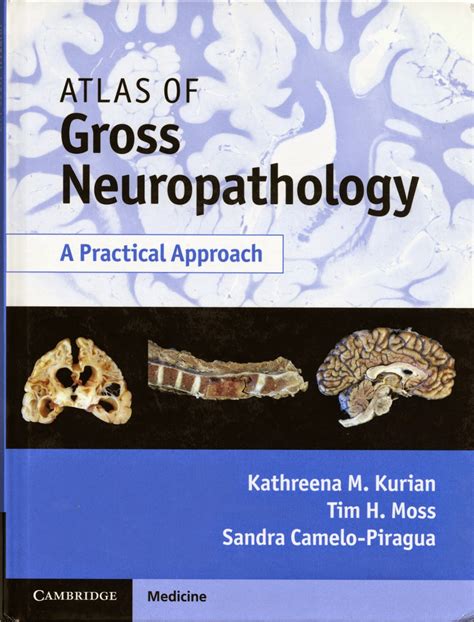 Read An Atlas Of Gross Neuropathology Cesada 