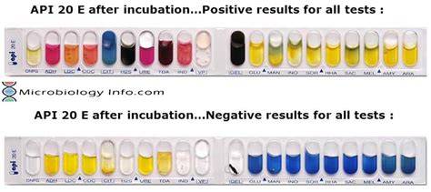 Analytical Profile Index