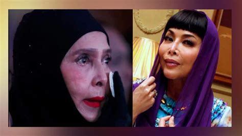 anita sarawak plastic surgery