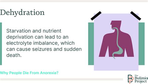 Anorexia And Dehydration