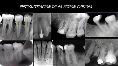 Antónimo De Cariñosa