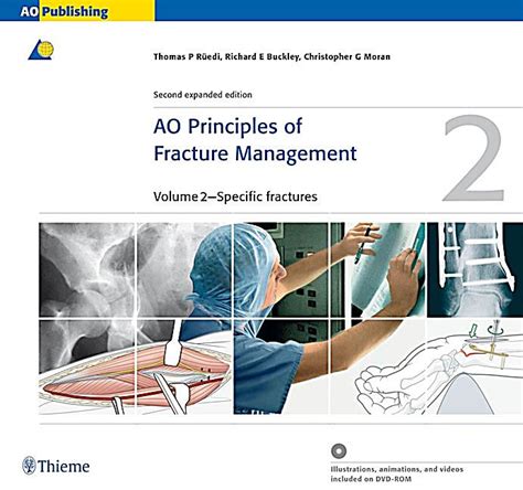 Read Ao Principles Of Fracture Management Second Expanded Edition Free Download 