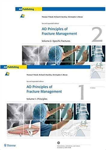 Read Ao Principles Of Fracture Management Second Expanded Edition Free Download 