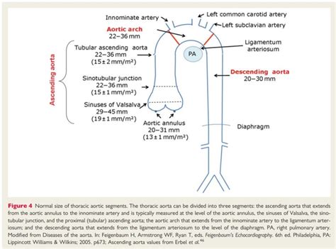 Aortic Root Diameter Normal