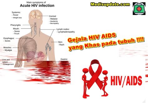 apa saja gejala hiv