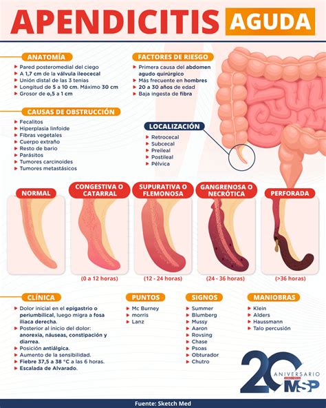 Apendicitis Aguda 52
