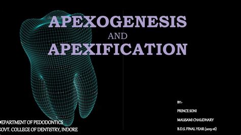 apexification and apexogenesis ppt able designs