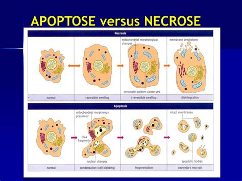 Apoptose E Necrose