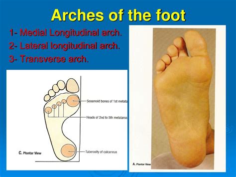 Read Online Arches Of Foot Ppt 