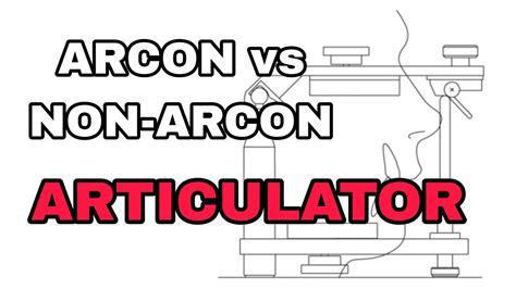 Arcon Vs Non Arcon