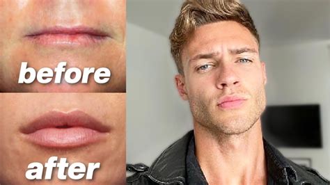 are big lips attractive on men