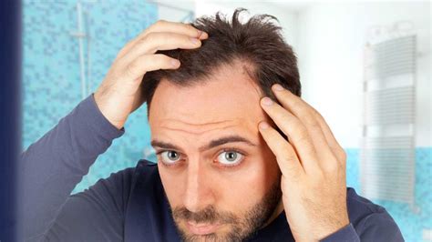 are there dating sites for men losing their hair?
