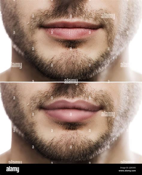 are thin lips attractive as a male