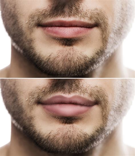 are thin lips attractive as aging skin men