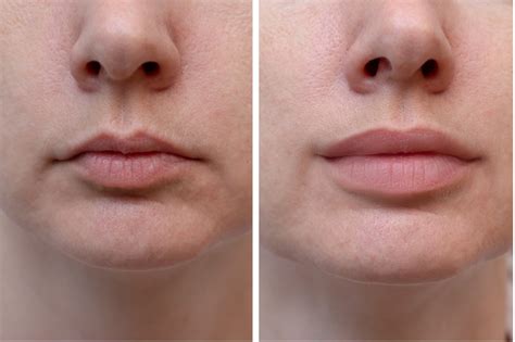 are thin lips attractive likely to go wrong