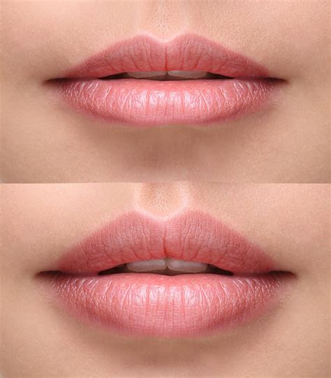are thin lips attractive without mask