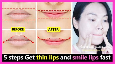 are thin lips attractive without surgery