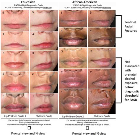 are thin lips dominant behavior disorder signs