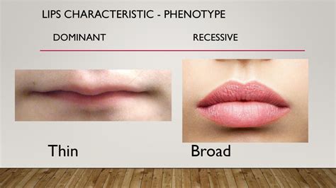 are thin lips dominant or recessive disorders associated