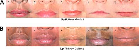 are thin lips genetic illness symptoms